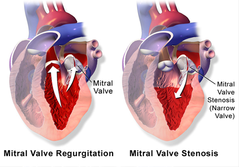 Cardiology Hospitals in india