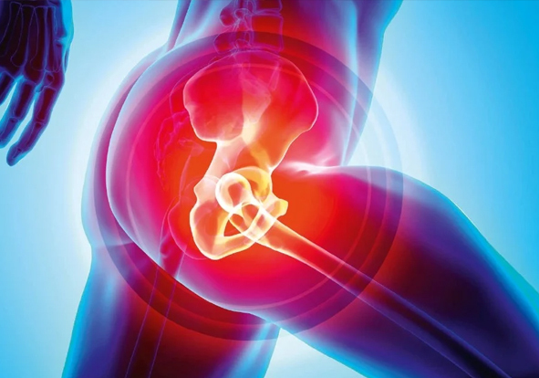 Hip replacement surgeon in india