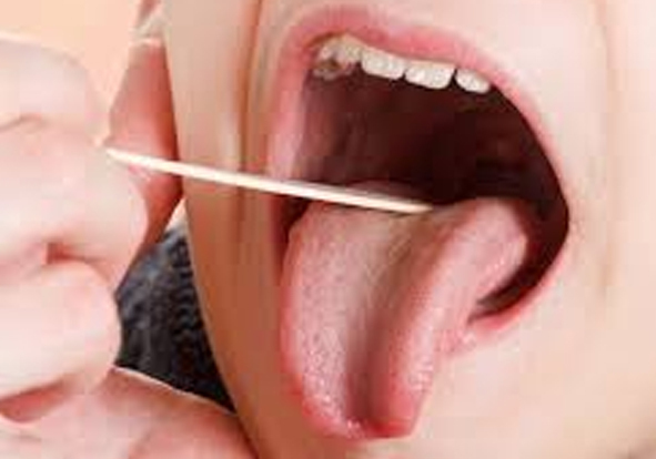 Oral Cancer Surgeon in india